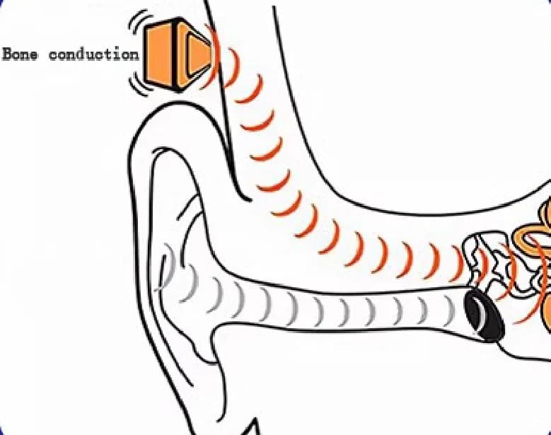 Are Bone Conduction Headphones Safe